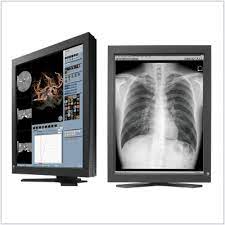Monitor para RX Ecografias e Tomografias